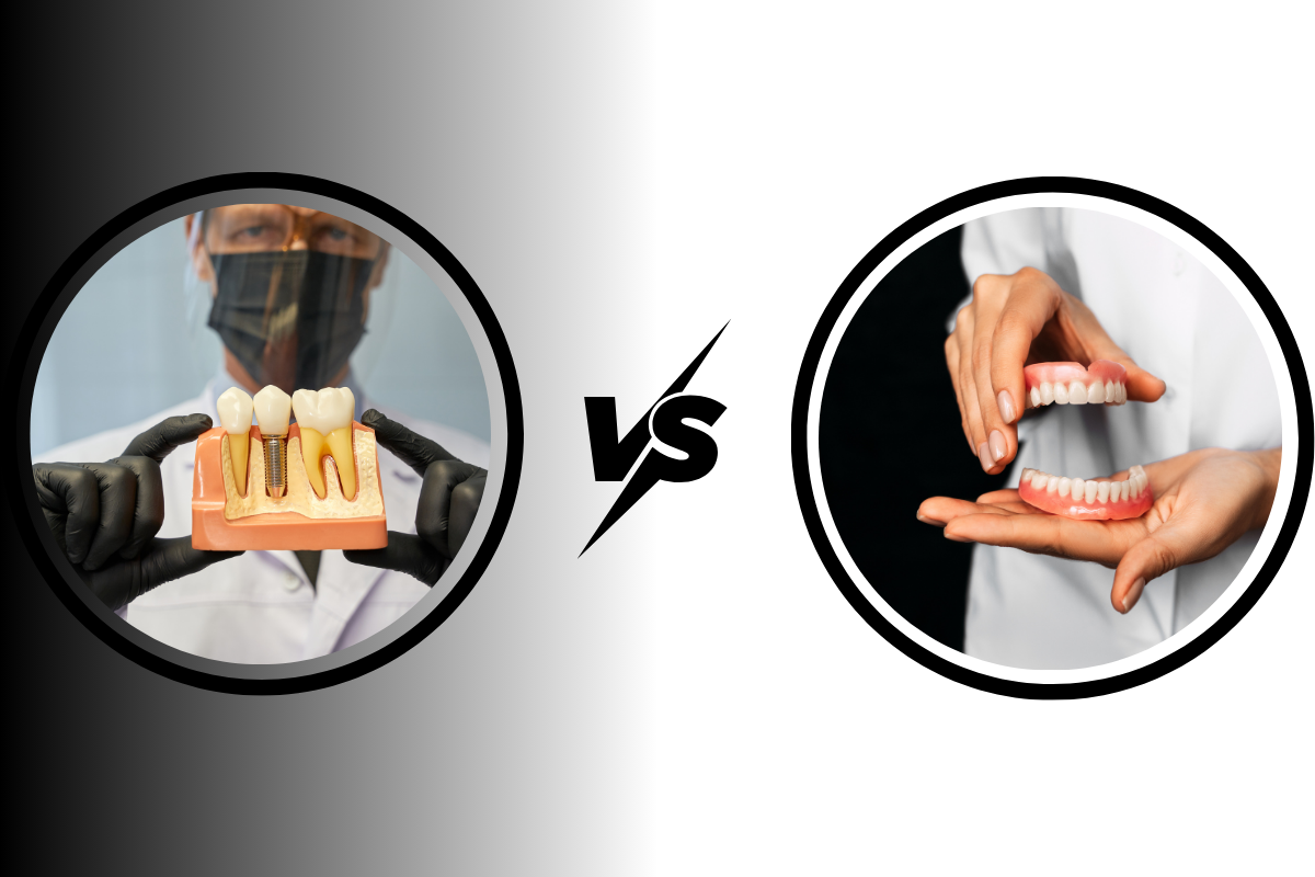 Dental Implants vs. Dentures: