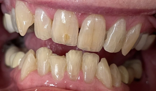 General Dentistry in Garner